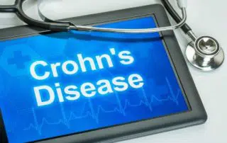 Symptoms and causes of Crohn's Disease